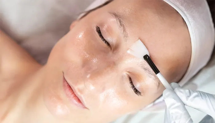 Image of Chemical Peels Section