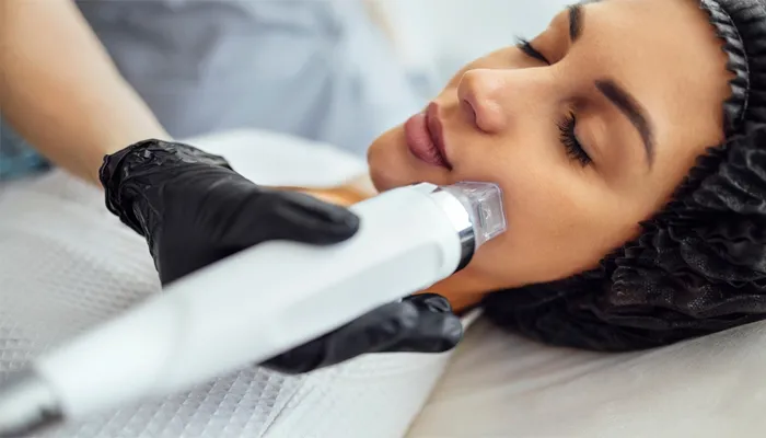 Image of Microneedling with PRP Section