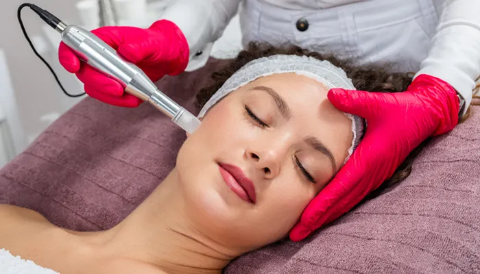 Image of Microneedling with PRP Section 2