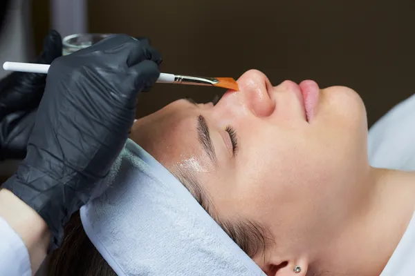 Superficial Peels