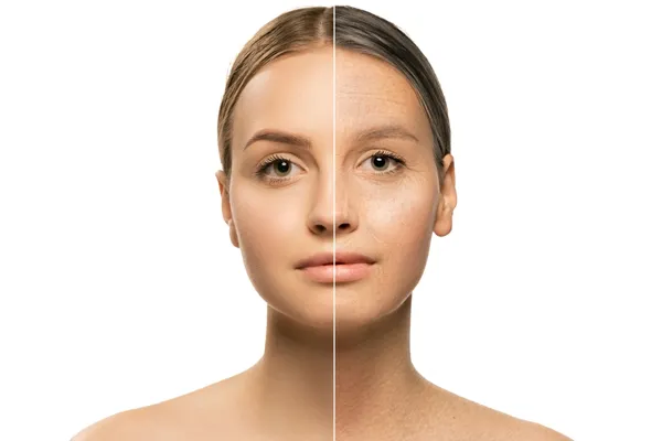 Wrinkle Reduction
