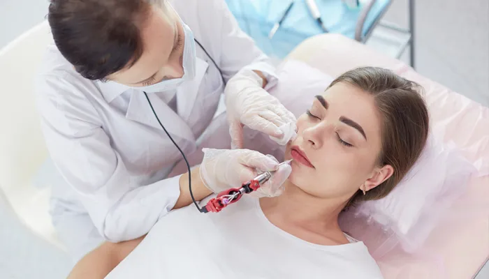 Chemical Peels for Lip Rejuvenation