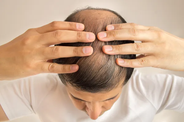 Hair Restoration